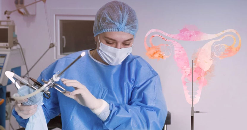 هیستروسکوپی