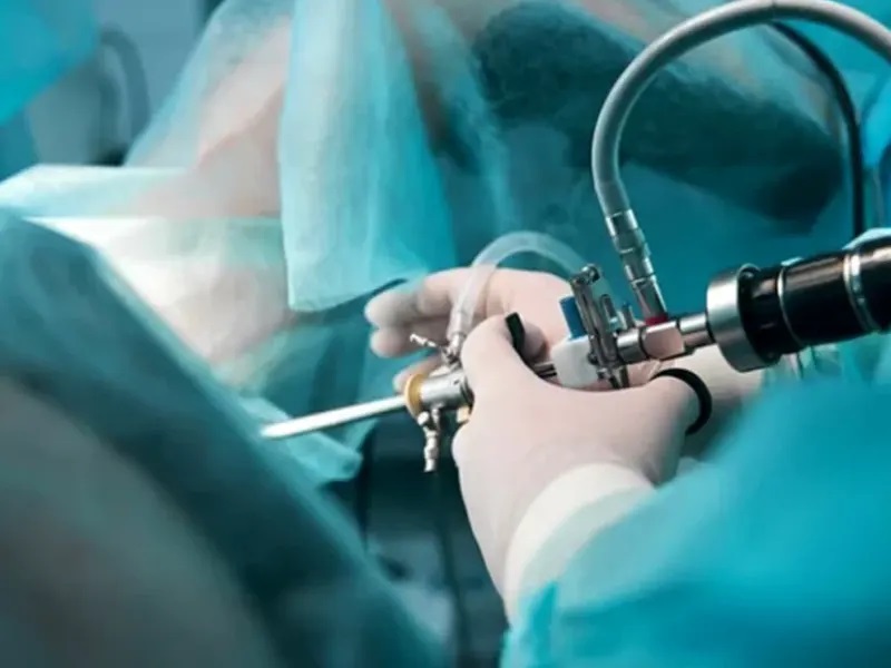 هیستروسکوپی