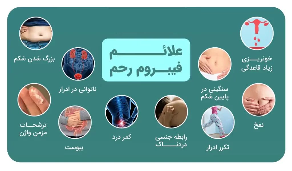 علائم فیبروم رحم