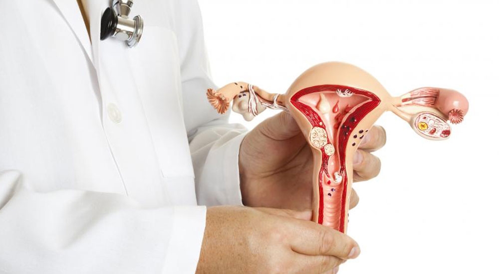 فیبروم چگونه درمان می شود؟