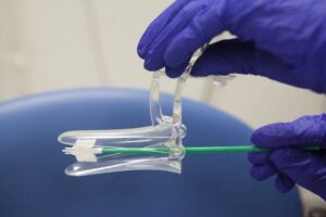 ابزار تست پاپ اسمیر