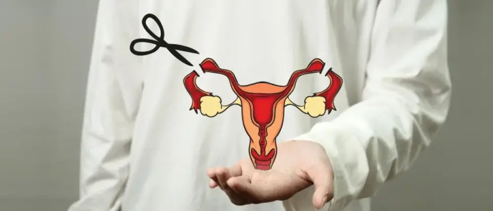 توبکتومی یا بستن لوله ‌های رحمی؛ مخصوص چه کسانی است؟