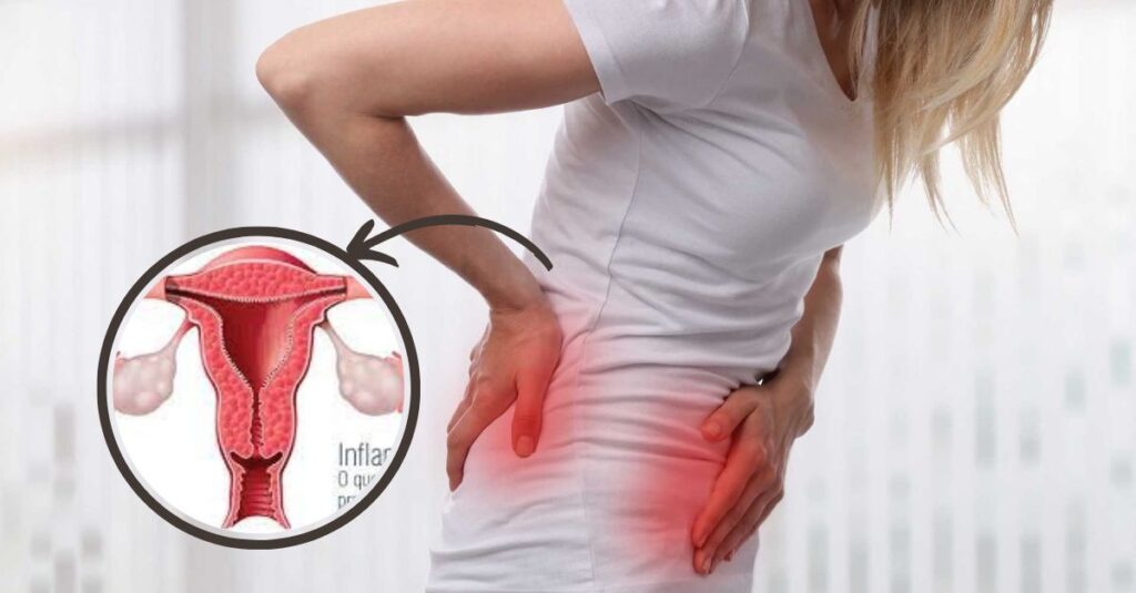 افتادگی رحم، مشکل بسیاری از بانوان