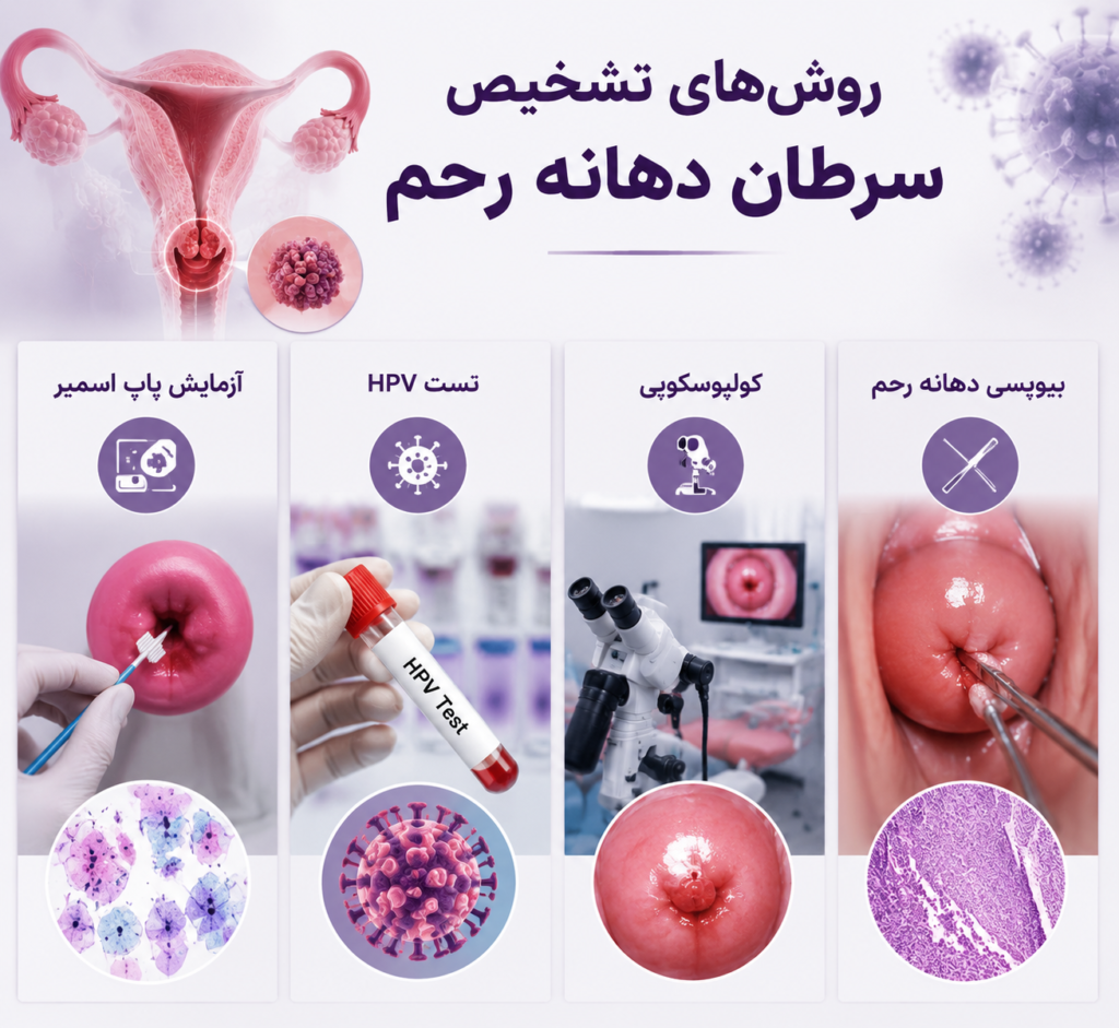 تشخیص سرطان دهانه رحم در مراحل اولیه؛ علائم و روشها