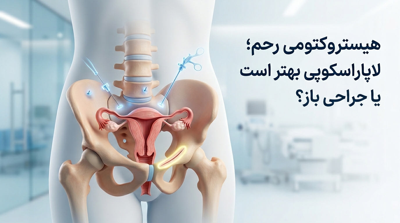 هیستروکتومی رحم؛ لاپاراسکوپی بهتر است یا جراحی باز؟