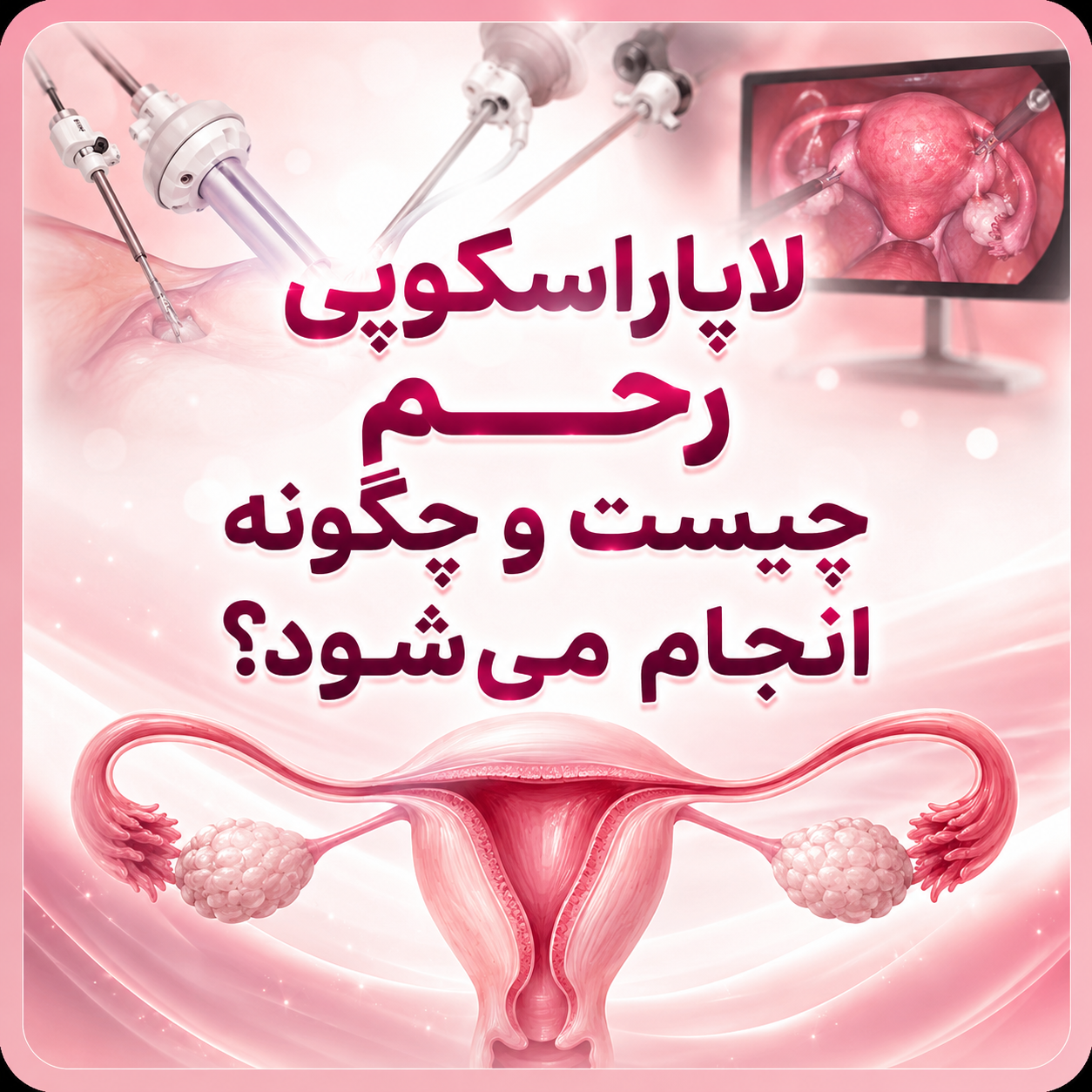 لاپاراسکوپی رحم چیست و چگونه انجام می‌شود؟