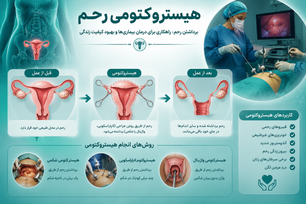 هیستروکتومی رحم در مشهد؛ زمان مراجعه و روش‌های جراحی