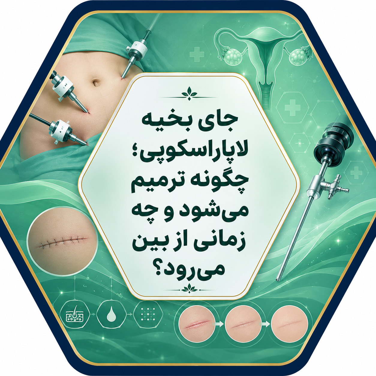 جای بخیه لاپاراسکوپی؛ چگونه ترمیم می‌شود؟